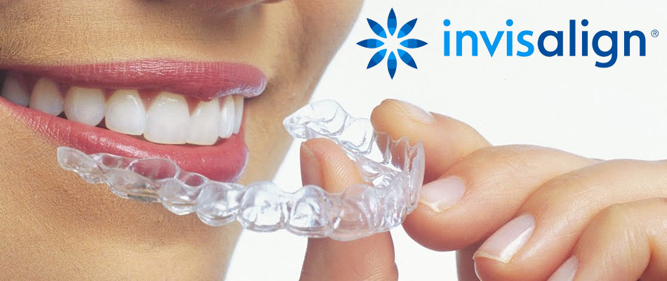 INVISALIGN